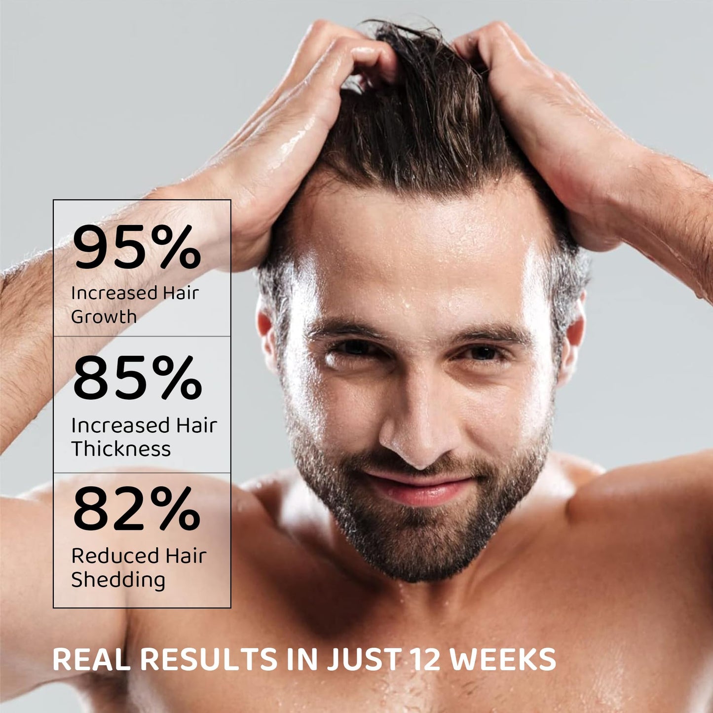 Sulfate free hair loss shampoo for men showcasing the 10.1 fluid ounce packaging