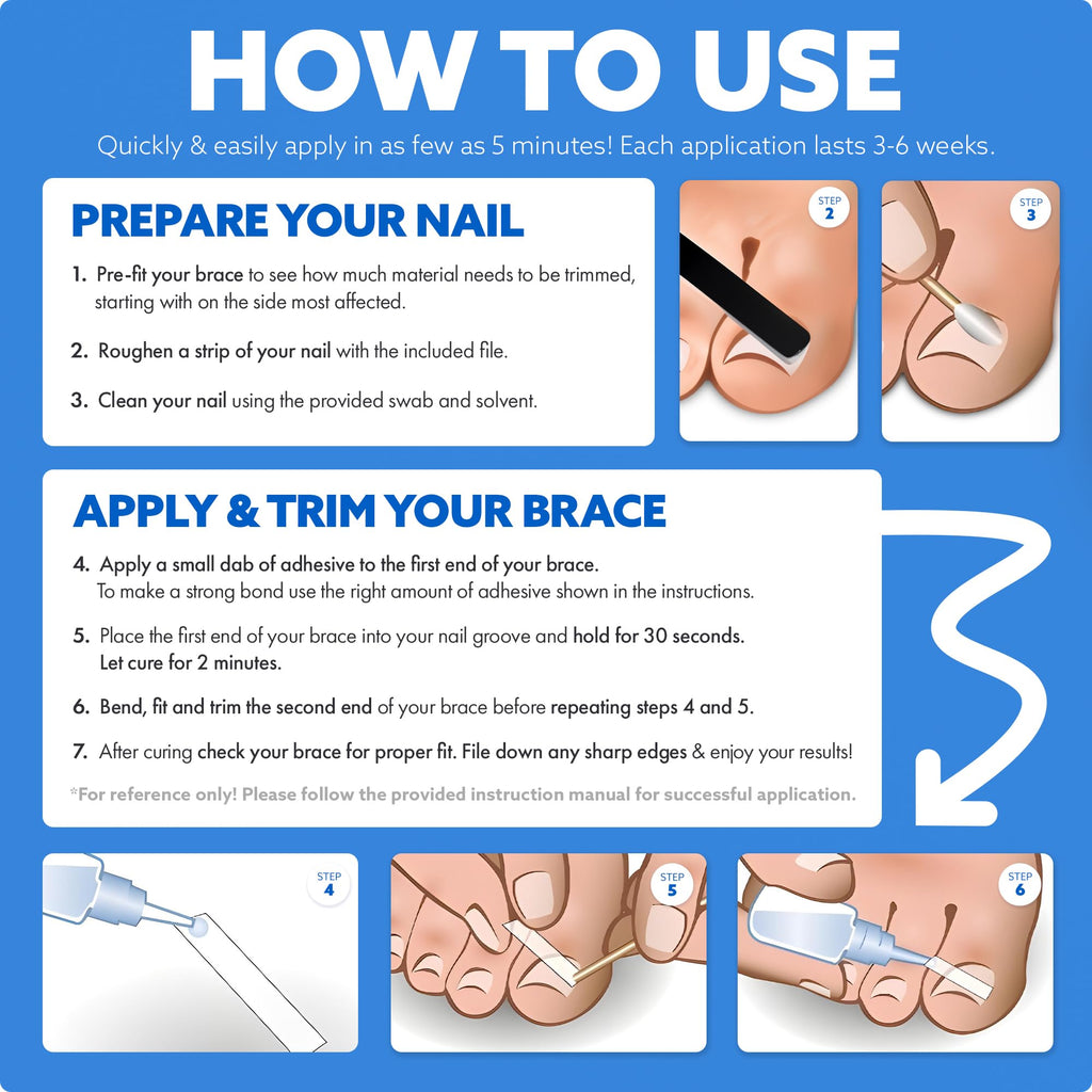 Close up of medical grade adhesive for toenail braces