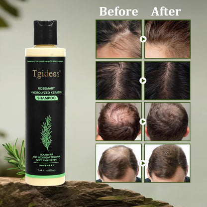 Tgideas biotin and rosemary hair growth formula bottle standing upright