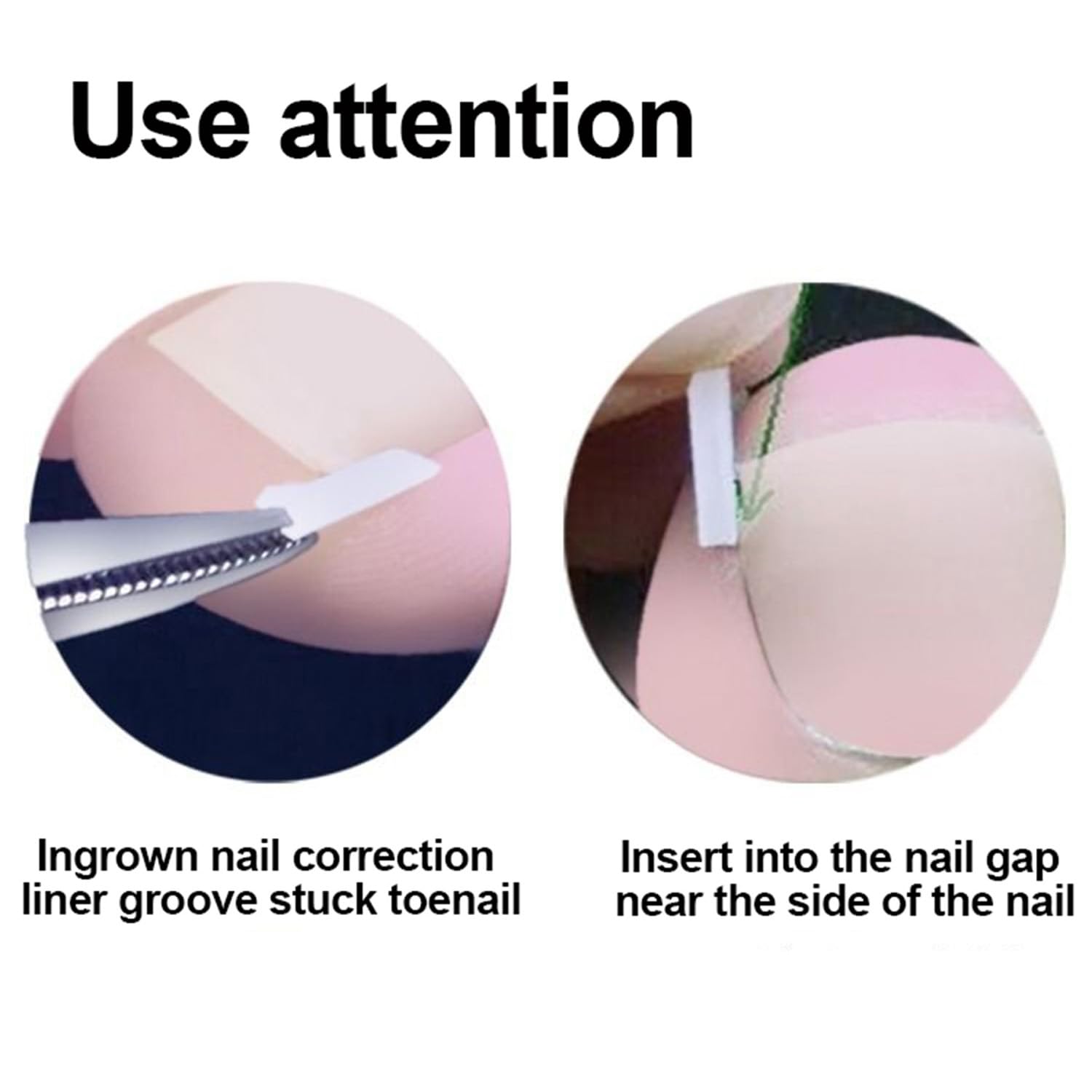 Demonstration of the breathable rectangular corrector patch applied safely onto a toe.