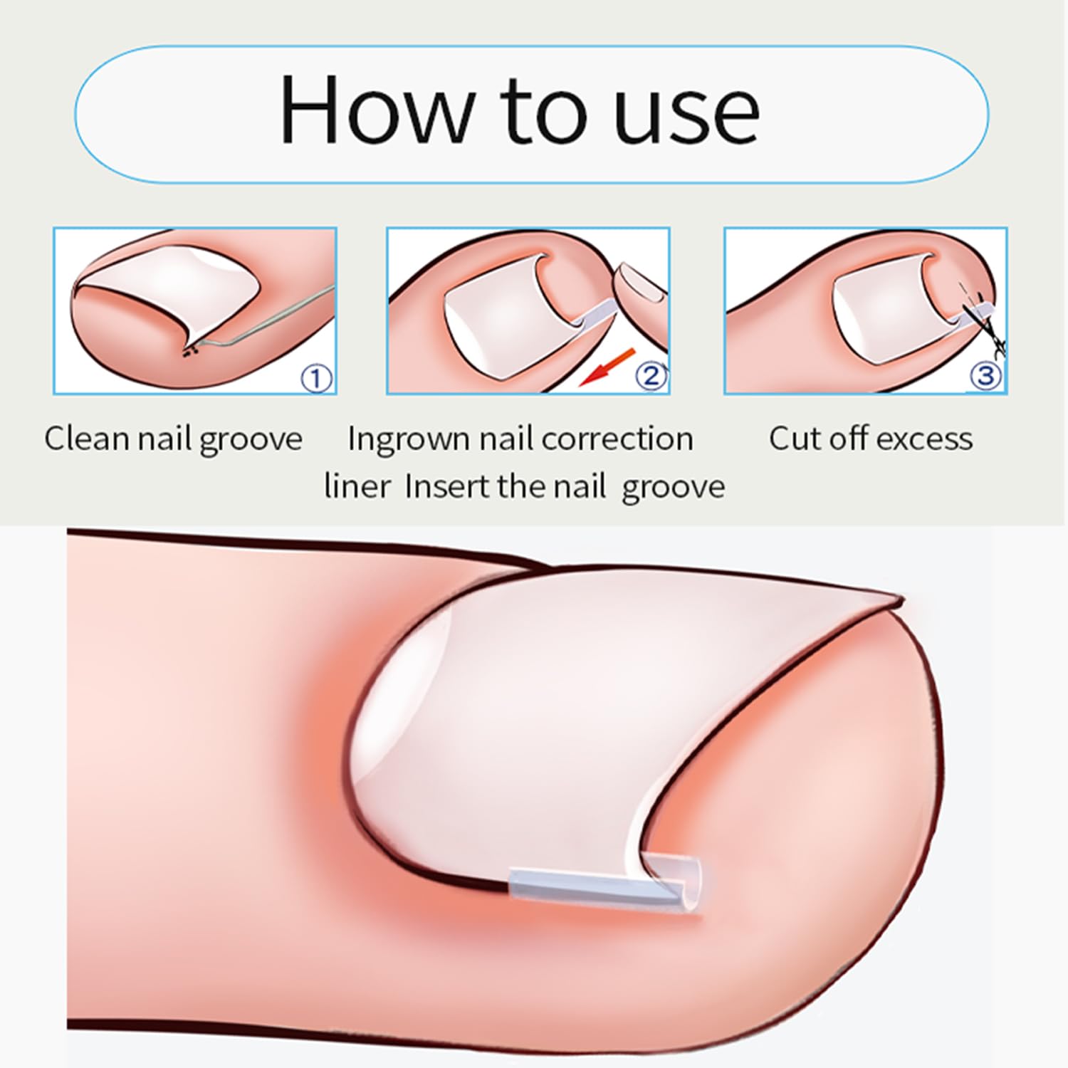 Different styles of elastic patches side by side showing application variety for different toe sizes.