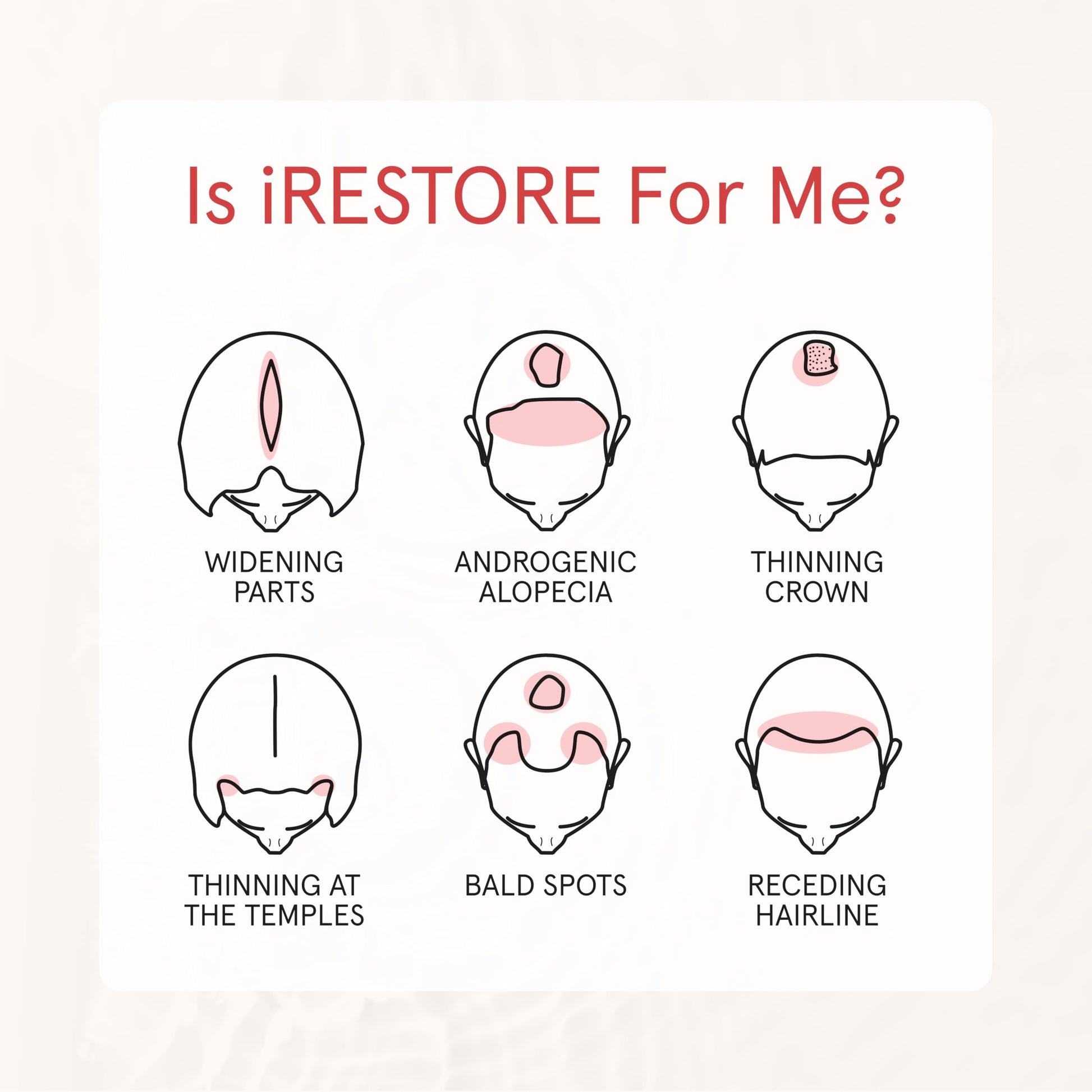 iRestore daily volumizing shampoo for men and women standing upright