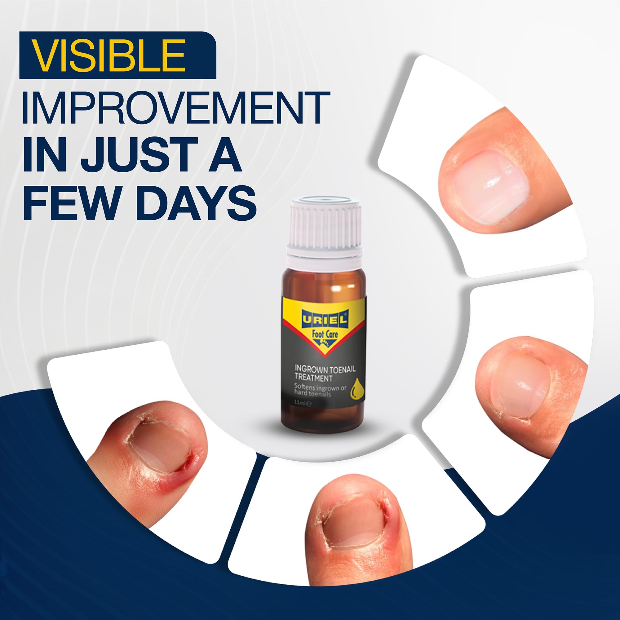 Uriel Ingrown Toenail drops 11 ml packaging box