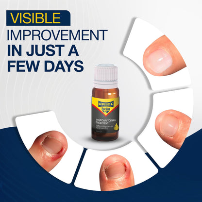 Uriel Ingrown Toenail drops 11 ml packaging box