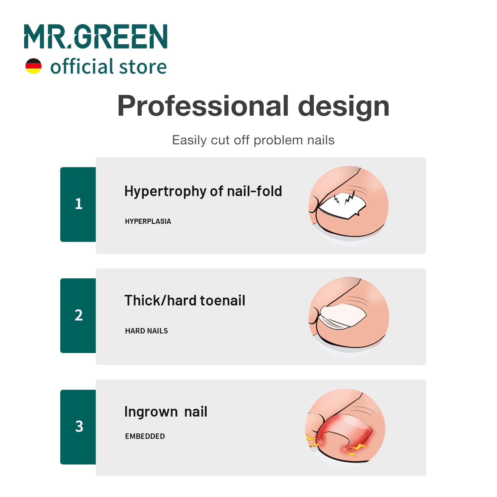 Close up of MR.GREEN toenail clipper olecranon blade design