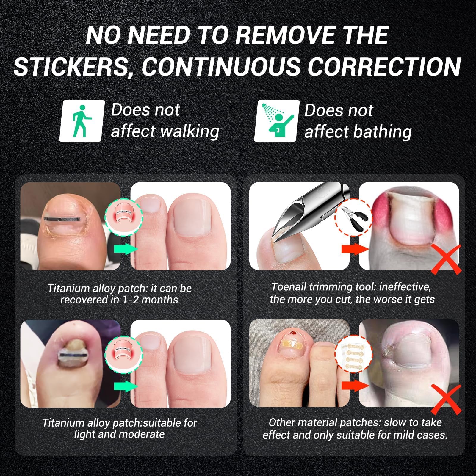Close up of Reieset nail correction patches and application tools