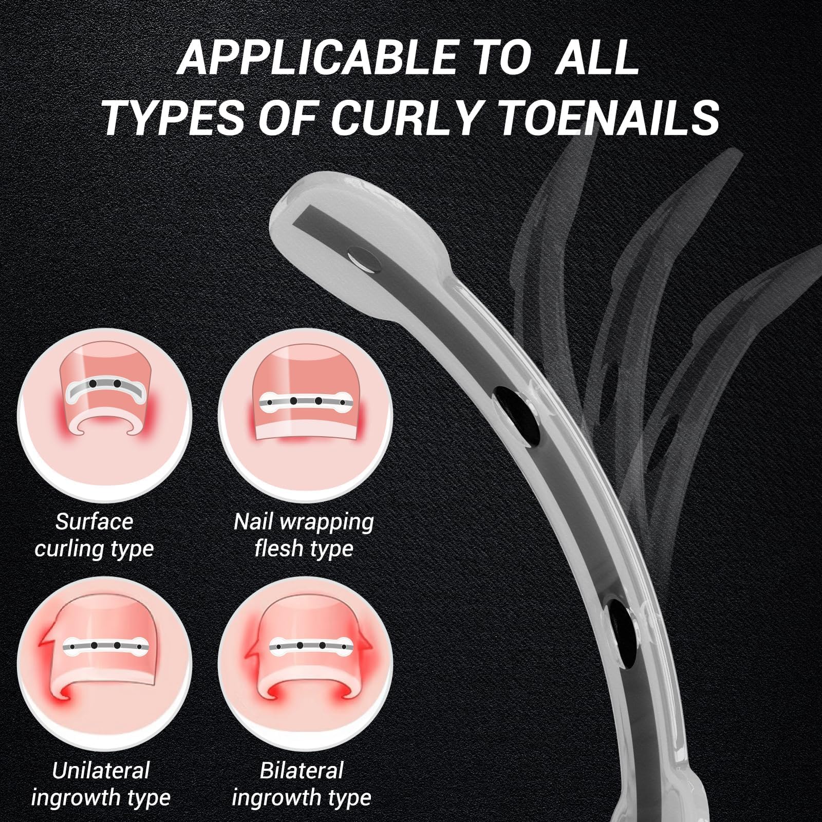 Side profile view of titanium alloy toenail corrector
