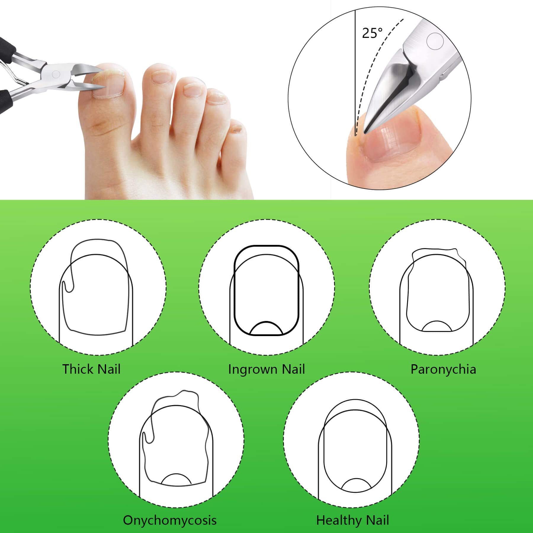 Feiccier ingrown toenail clippers with safety storage cap