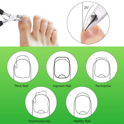 Feiccier ingrown toenail clippers with safety storage cap