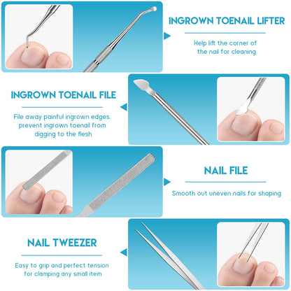 Complete pedicure tool kit for ingrown toenail relief