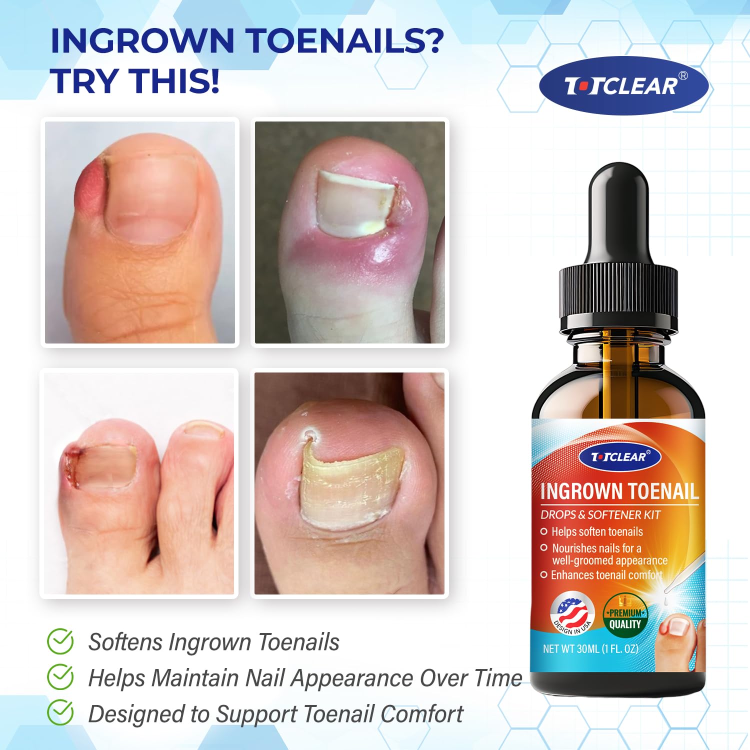 Totclear Ingrown Toenail corrector drops bottle close up