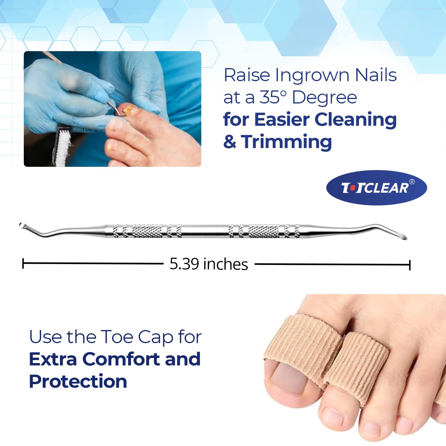 Step by step application of Totclear ingrown toenail treatment