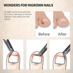 Close up of Feryes wide jaw toenail clipper blade