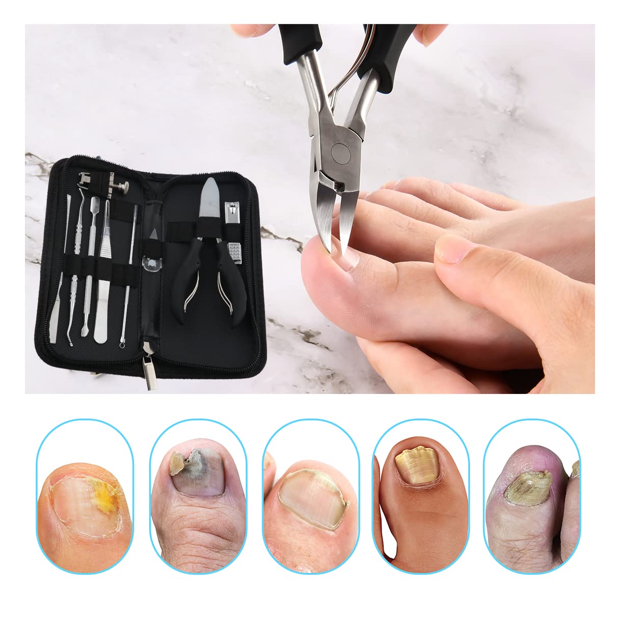Bcabo professional nail lifter and file set