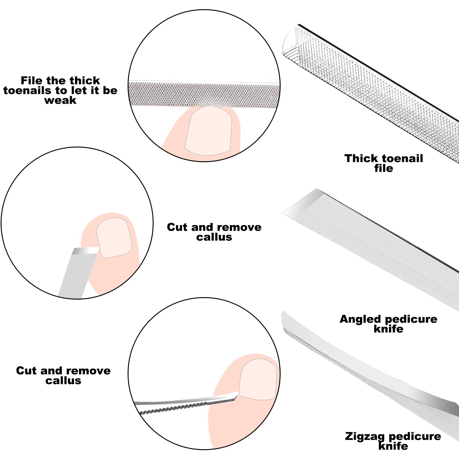 Zizzon nail care kit for ingrown toenail relief