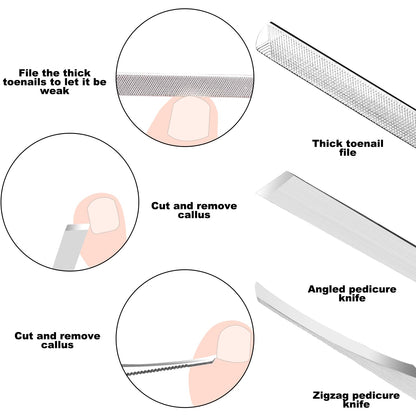 Zizzon nail care kit for ingrown toenail relief