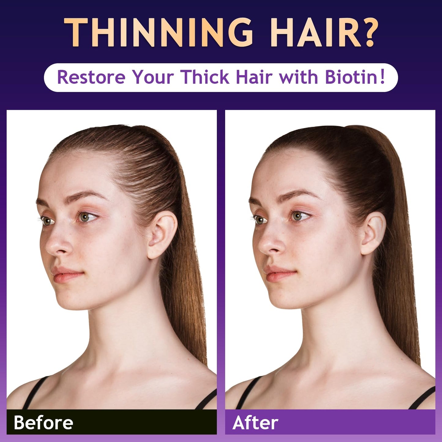 Oely anti hair loss shampoo bottle showing product volume and key natural ingredients