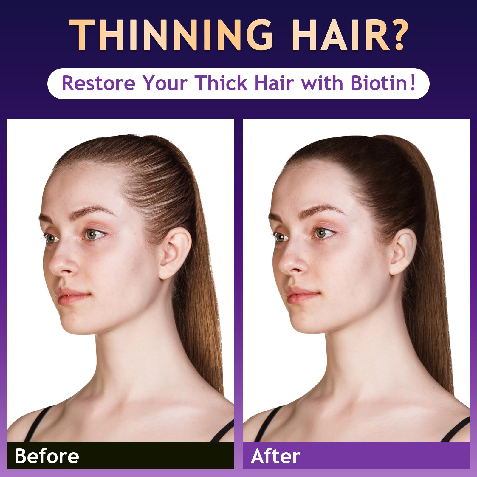 Oely anti hair loss shampoo bottle showing product volume and key natural ingredients
