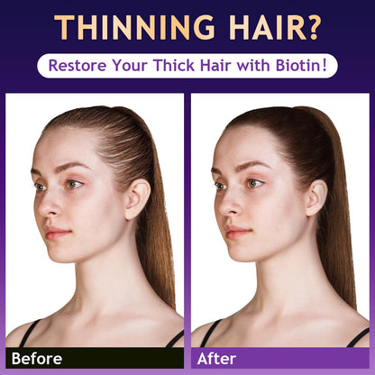 Oely anti hair loss shampoo bottle showing product volume and key natural ingredients