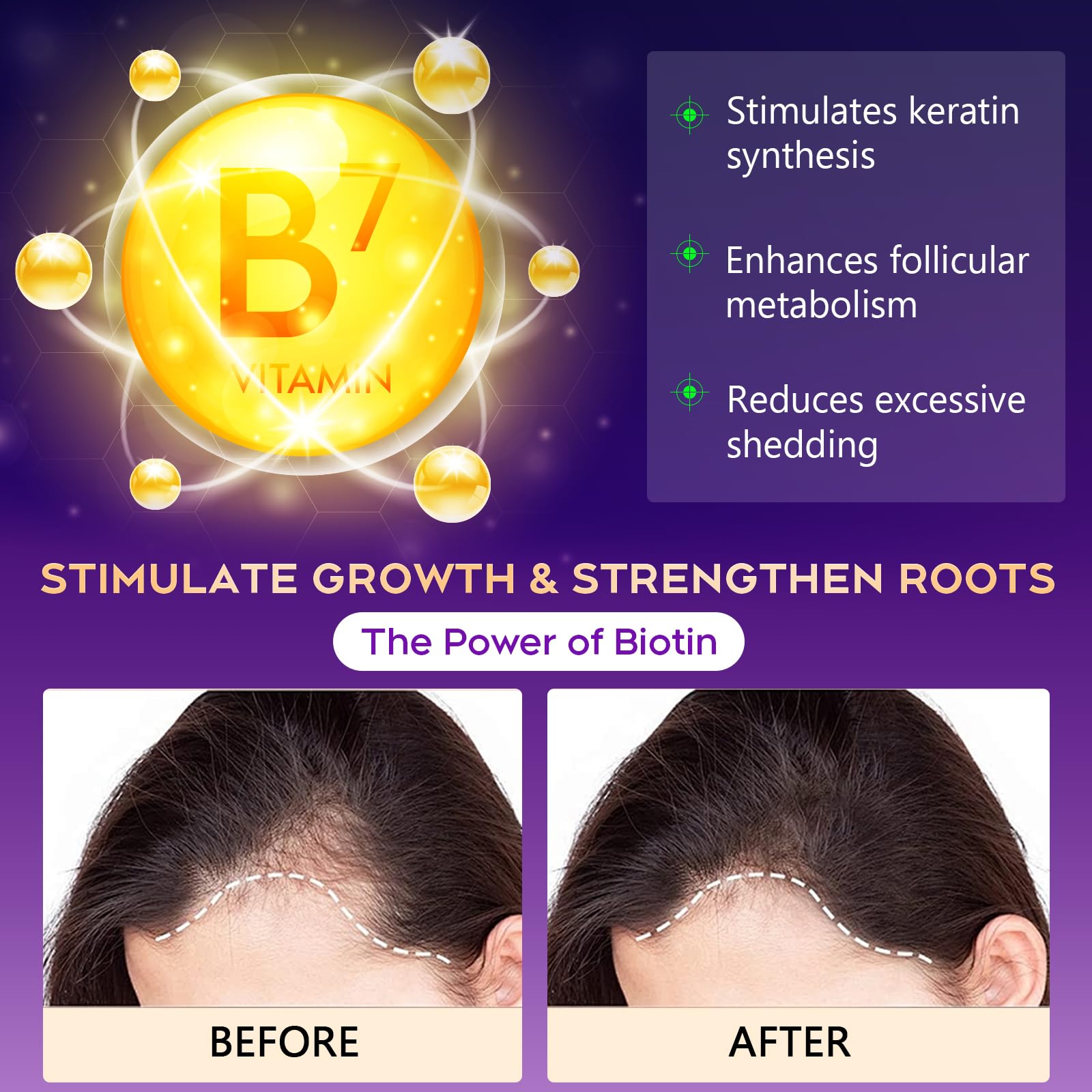 Oely root activator biotin shampoo for men and women hair thinning solution