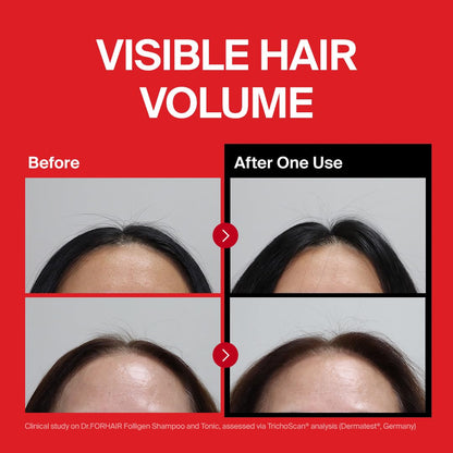 Dr.FORHAIR Folligen clarifying scalp care shampoo packaging details displaying biotin and ceramide ingredients.