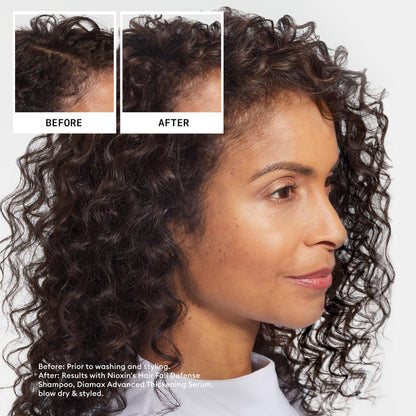 Nioxin professional salon shampoo for reducing hair fall and breakage