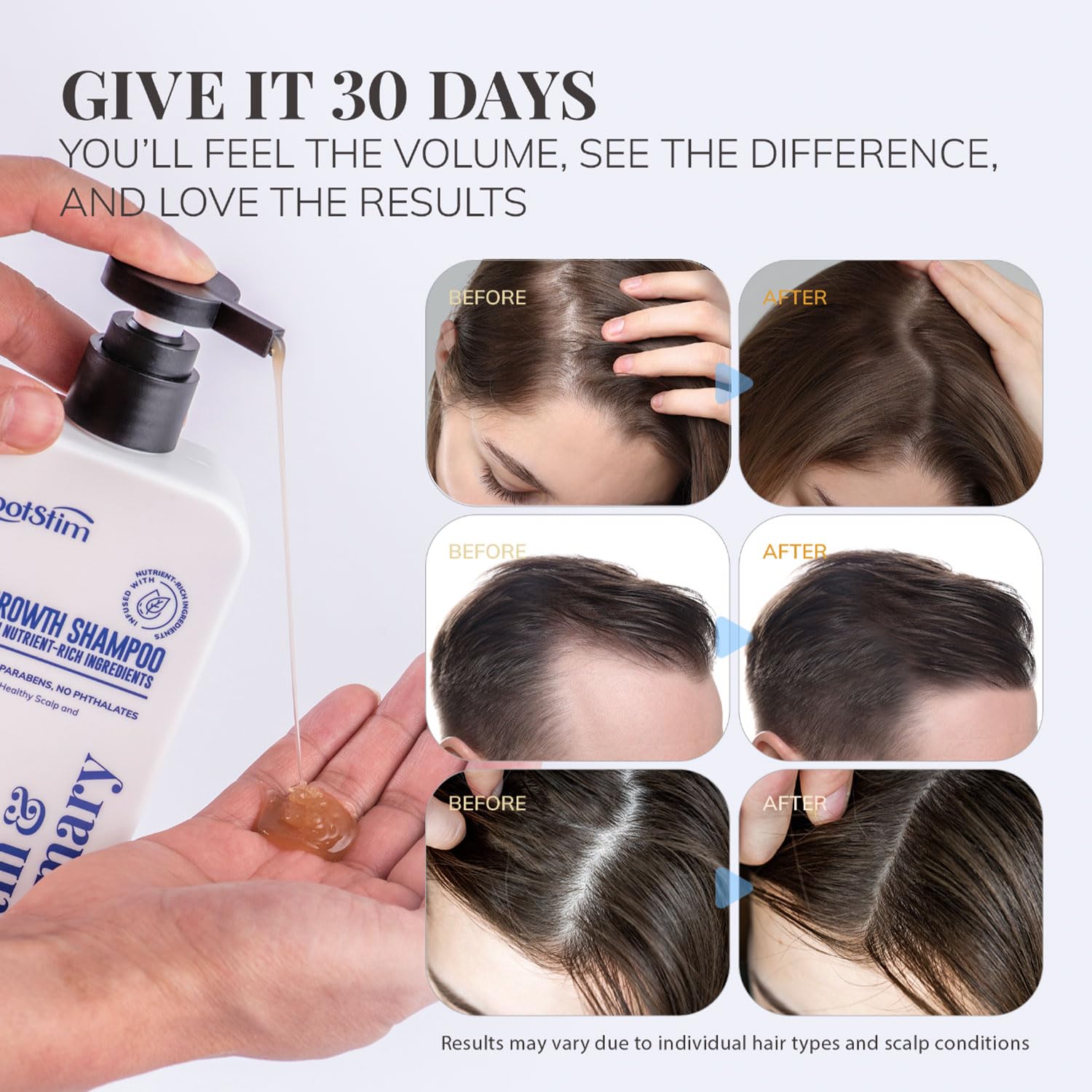 RootStim hair thickening shampoo with biotin and rosemary premium USA imported packaging
