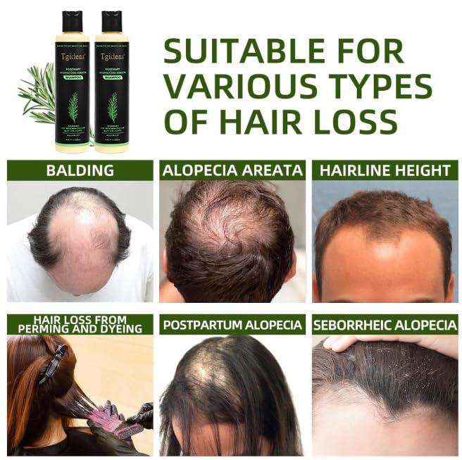 Tgideas anti hair loss volumizing shampoo bottle displaying fluid ounce volume.