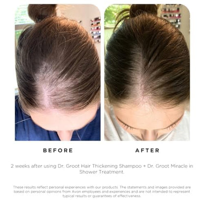 Dermatologist tested Dr Groot hair loss solution bottle close up