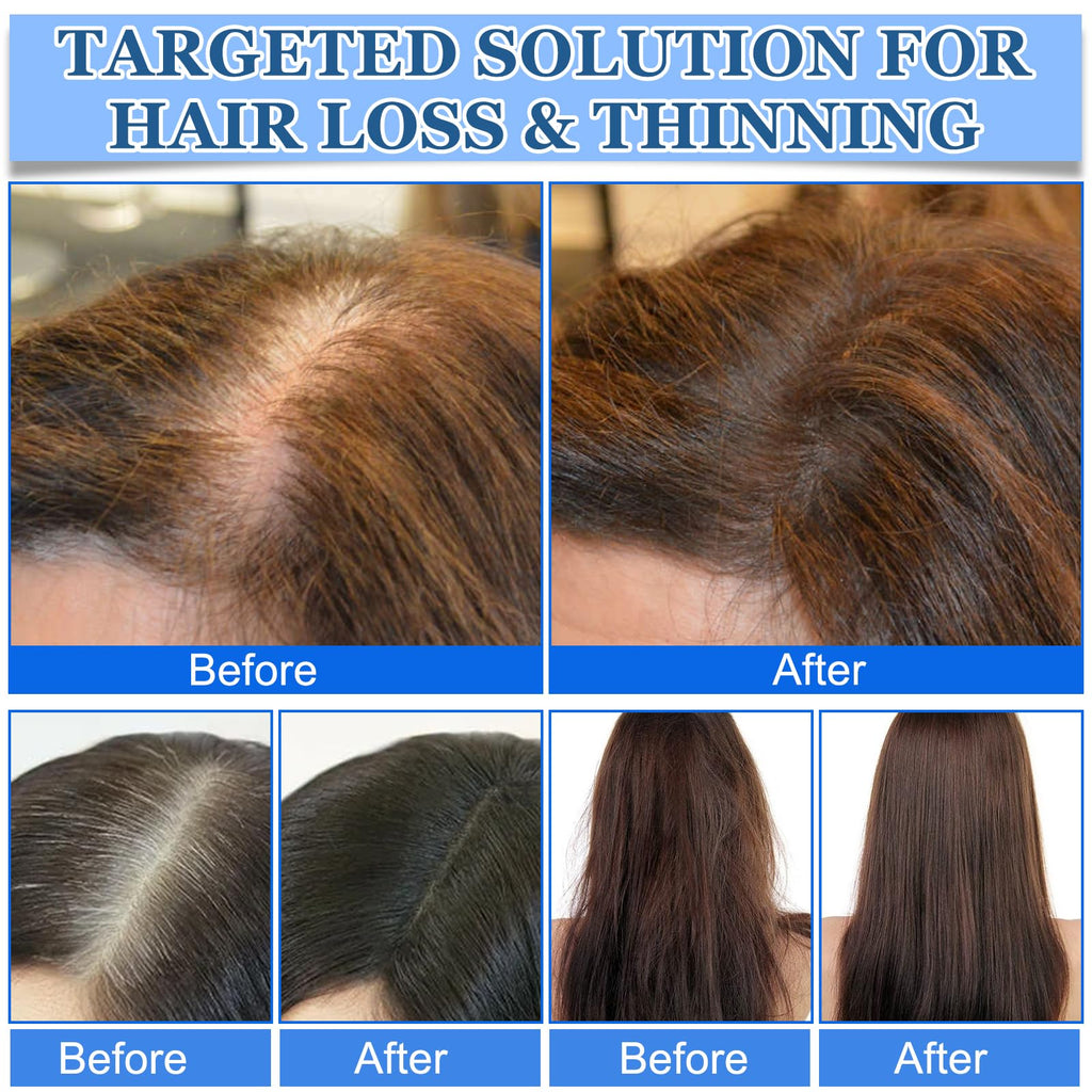 Mnevn hair growth serum roll on back label ingredients view