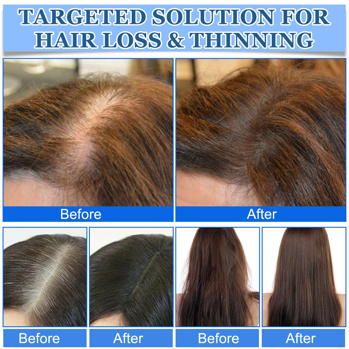 Mnevn hair growth serum roll on back label ingredients view