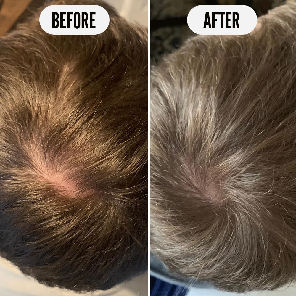 Noughty 97 percent natural hair thickening leave in treatment bottle with pea complex details