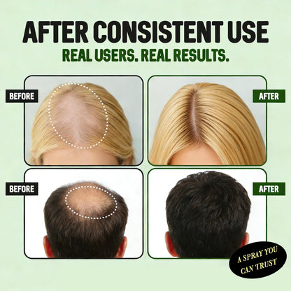 Before and after visualization of fuller hair density using LexTex treatment