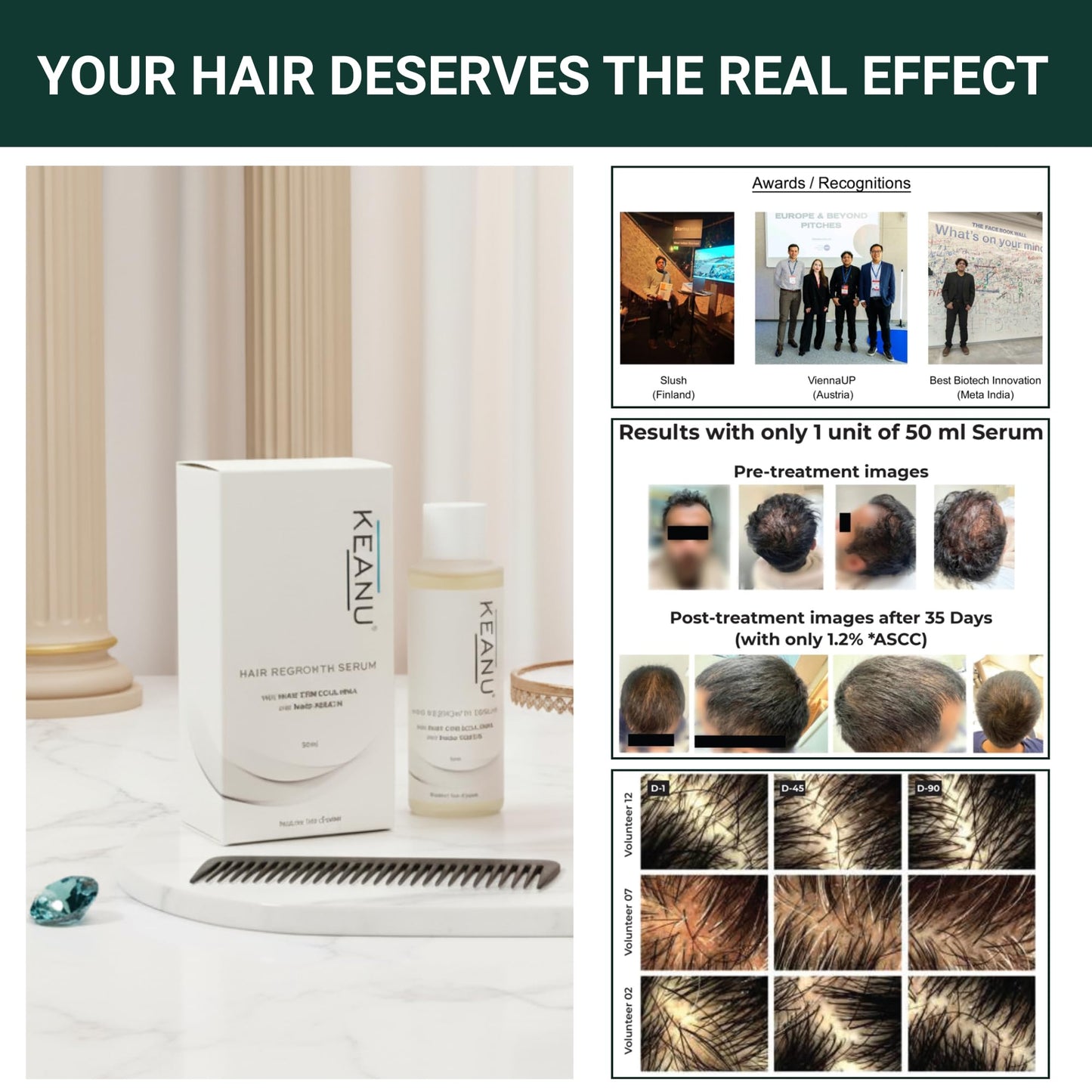 Glameura hair growth formula with plant stem cells and nano keratin for thinning hair