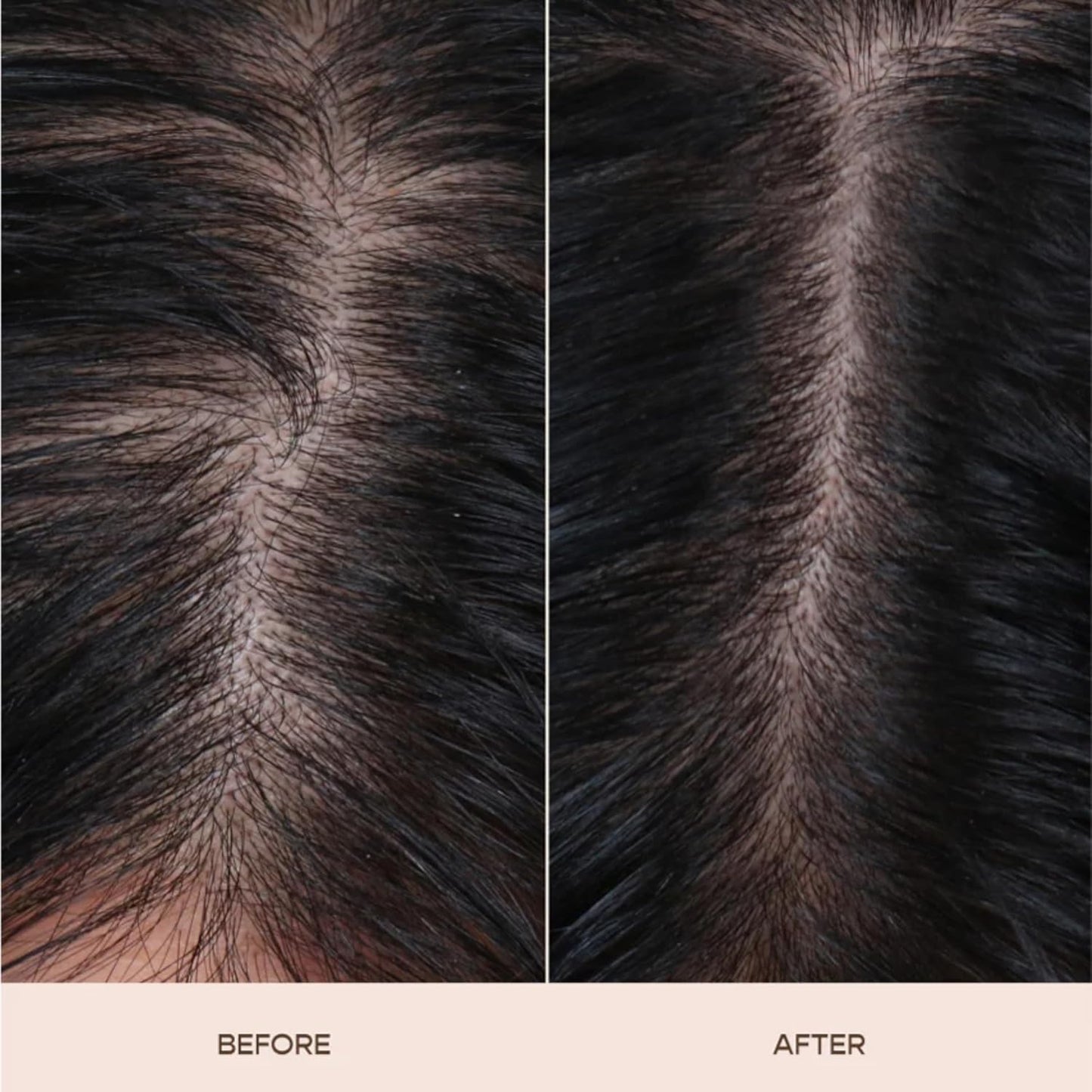 Ravel hair thinning treatment product label showcasing Rosemary and Pumpkin Seed