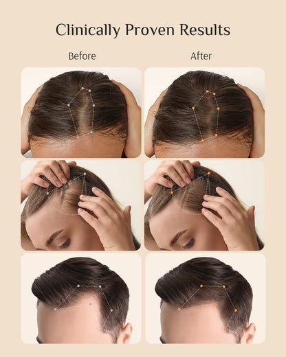 Japanese engineered hair loss serum for men featuring nanocapsule technology details