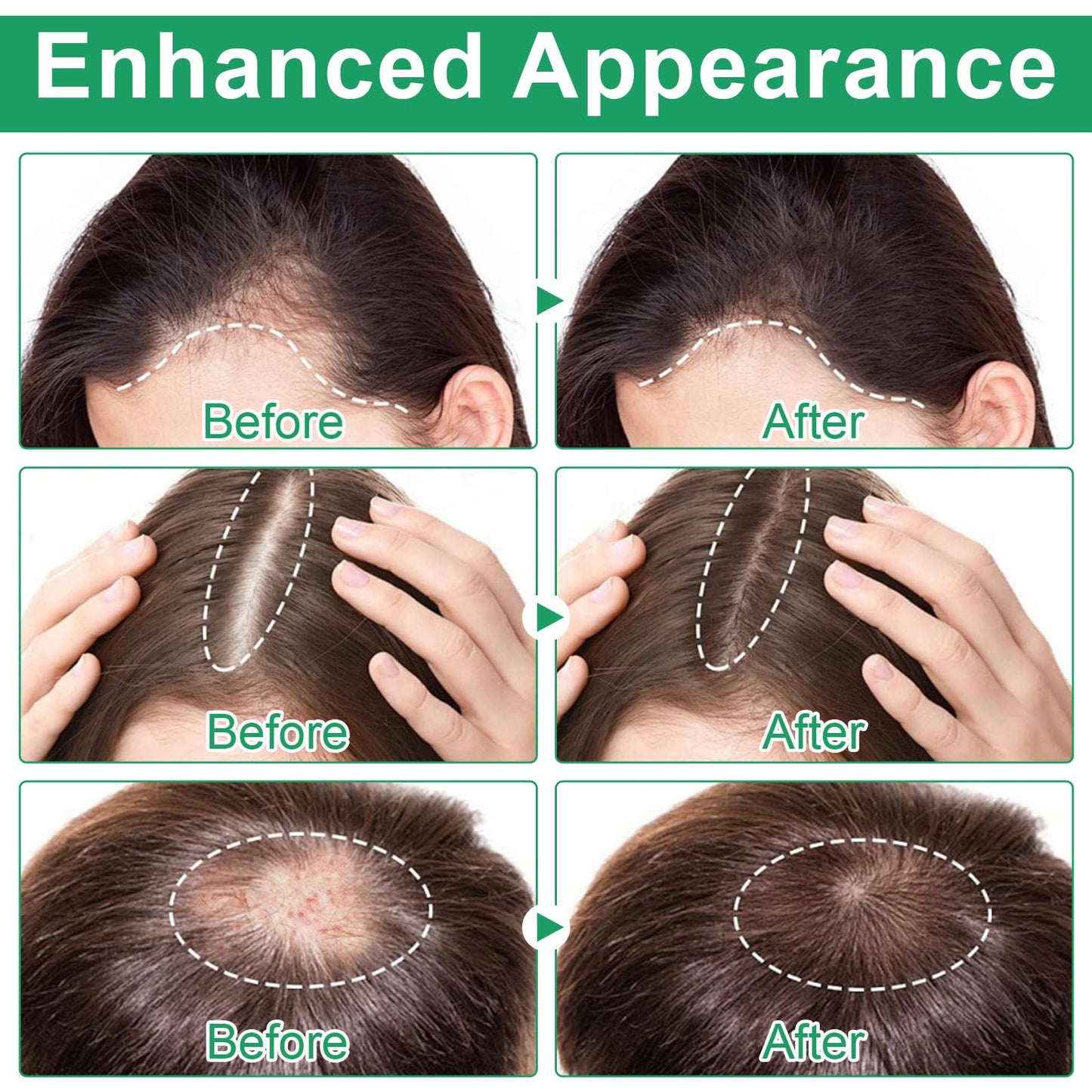 Fast absorbing non greasy hair growth serum for men and women