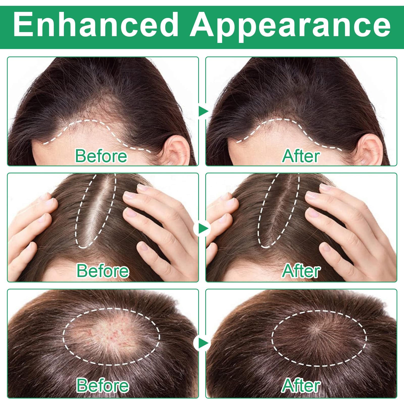 Fast absorbing non greasy hair growth serum for men and women