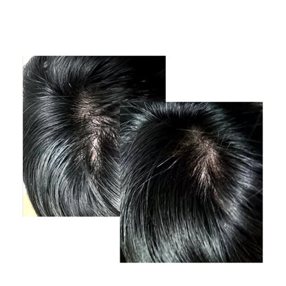 Non greasy Celonia hair treatment serum applied directly to thinning scalp area