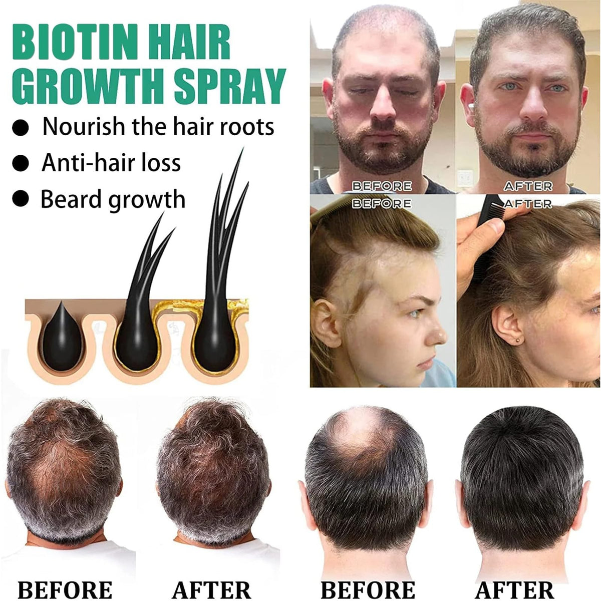 Grospe Godemmio Biotin Hair Growth Serum Spray ingredient label view