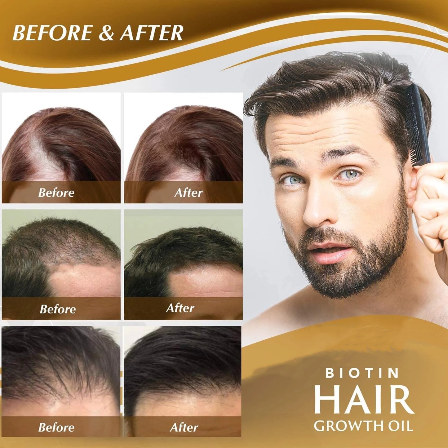 Godemmio biotin hair spray bottle displayed alongside fresh ginseng and ginger roots for ingredient visualization.