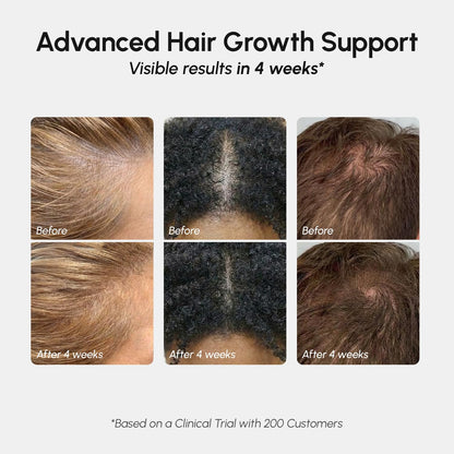 Authentic MAREE hair growth spray 65 ml packaging showcasing the professional biotin infused scalp care product.