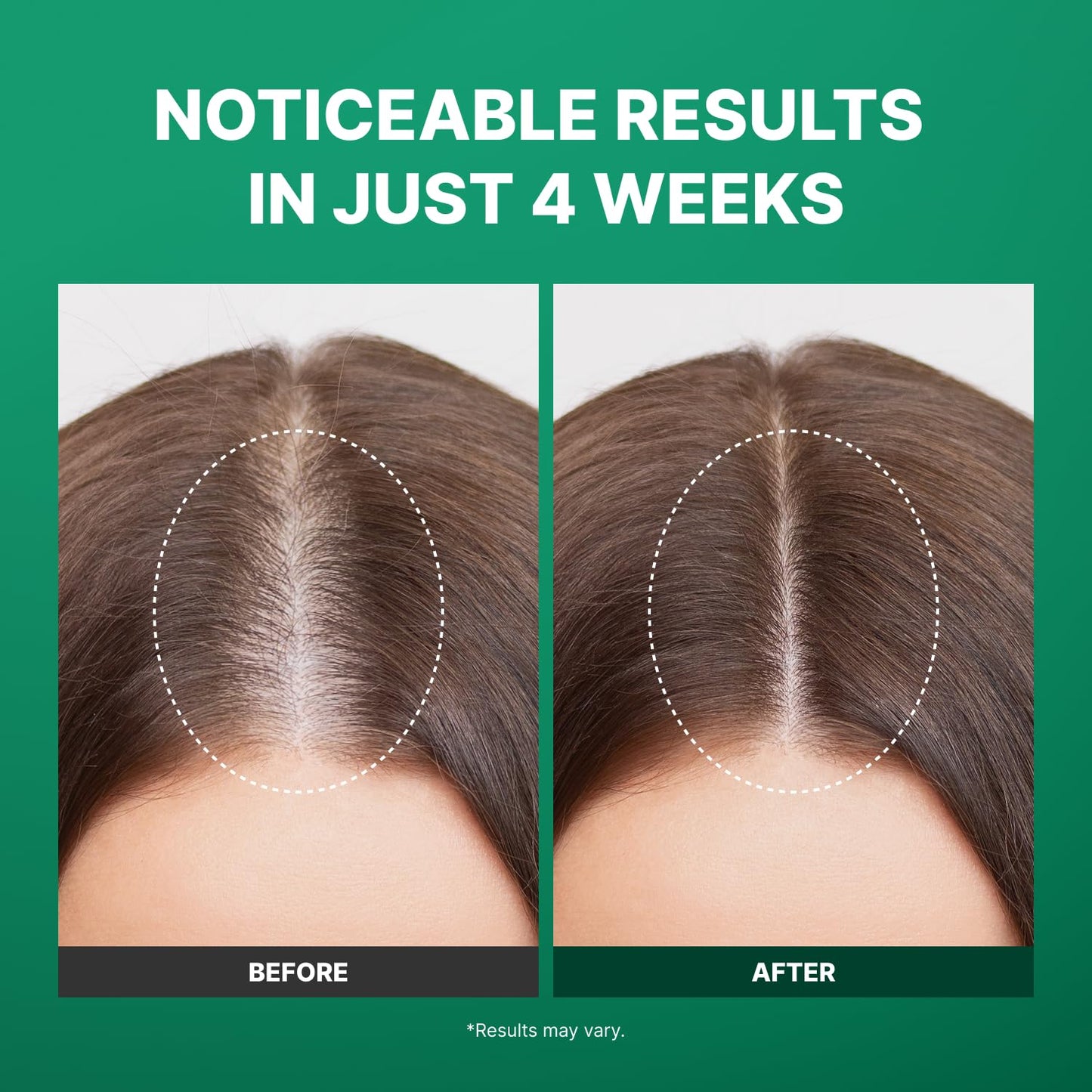 Fromforet Korean hair care scalp serum highlighting the precise roll-on applicator design.
