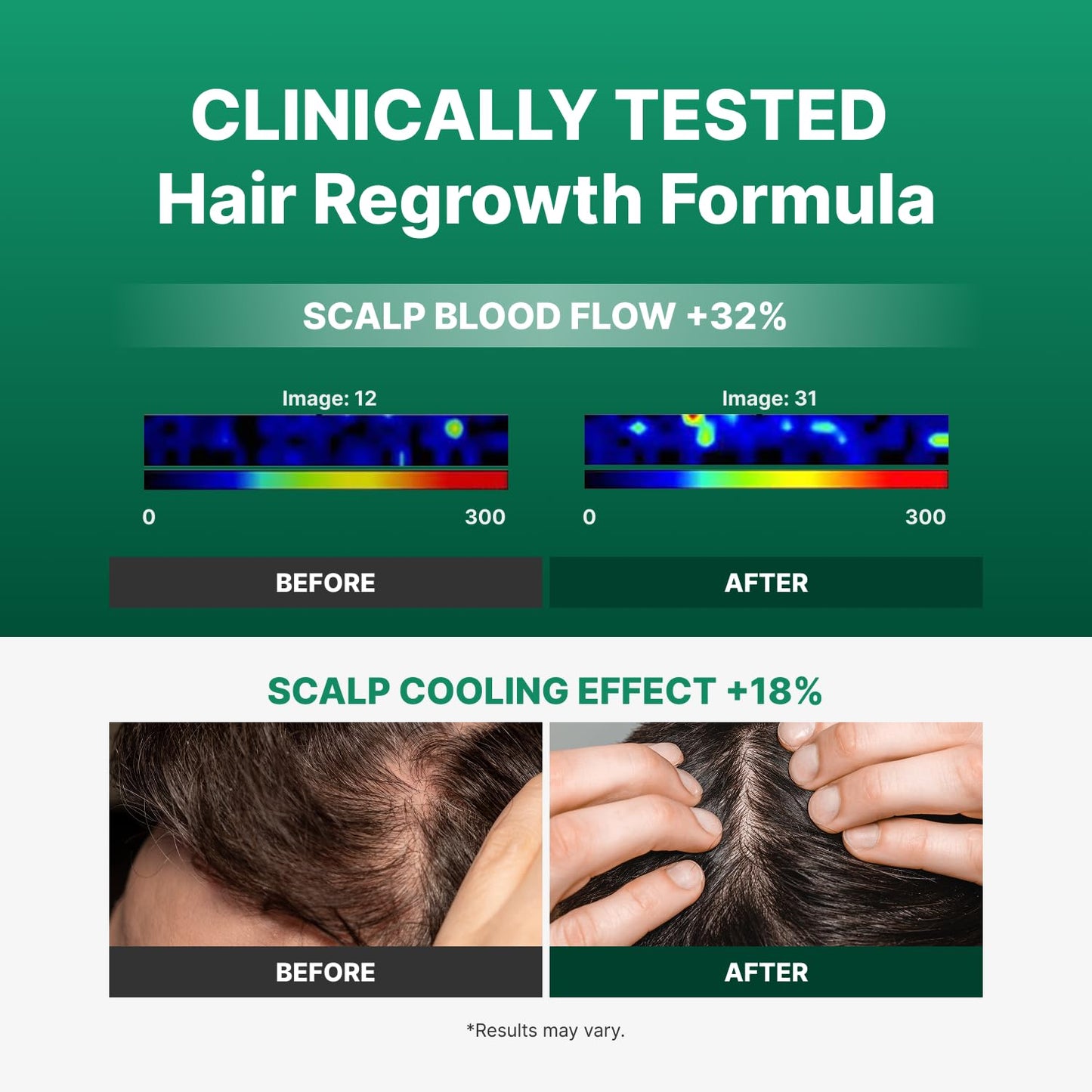 Spicule-Exosome hair ampoule packaging showing ingredients and instructions for hair restoration.
