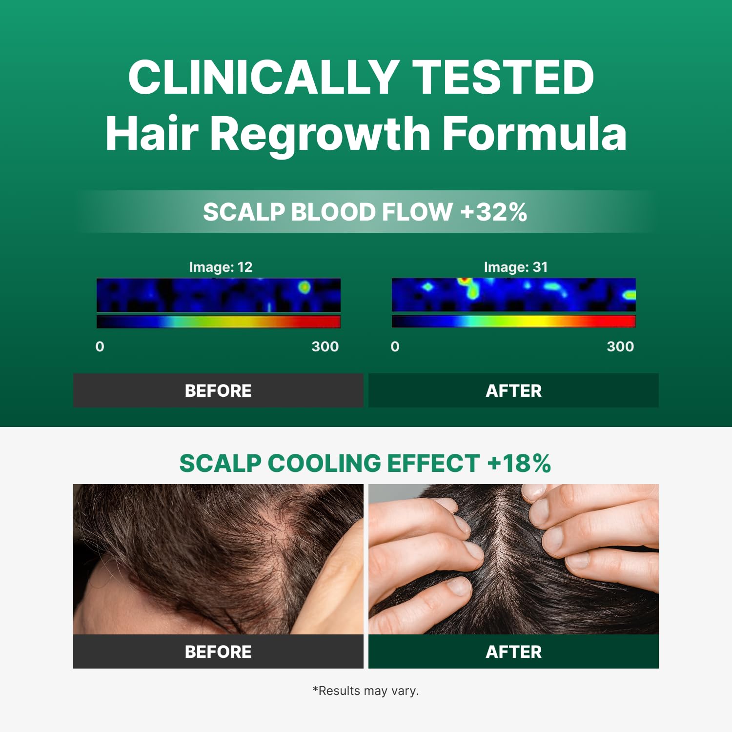 Spicule-Exosome hair ampoule packaging showing ingredients and instructions for hair restoration.