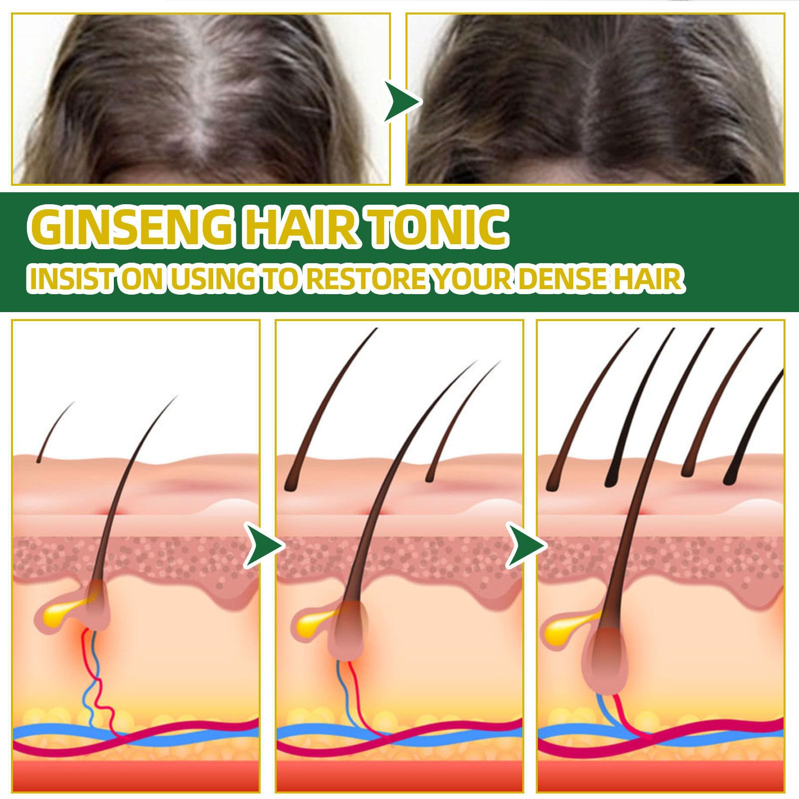 Lightweight non greasy hair thickening mist application on scalp.