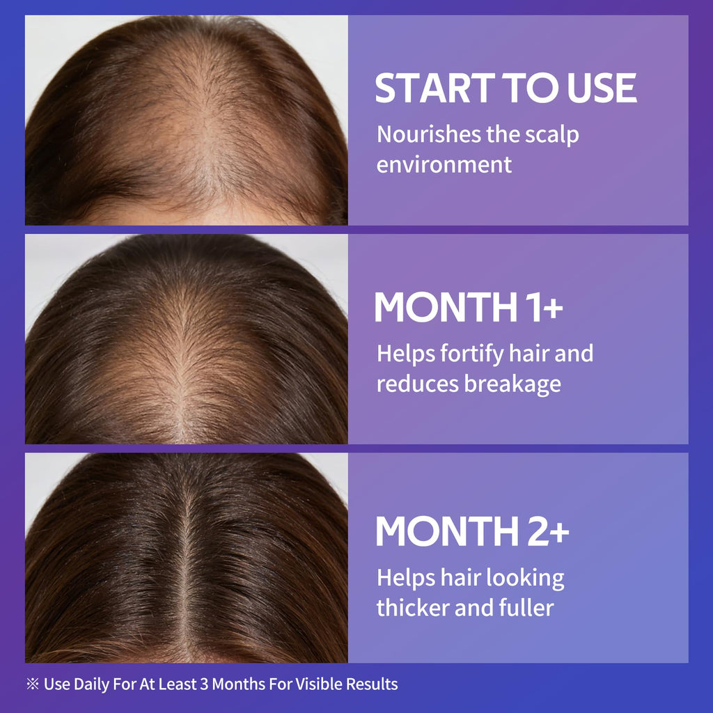 Close up of spray nozzle on hair growth serum bottle