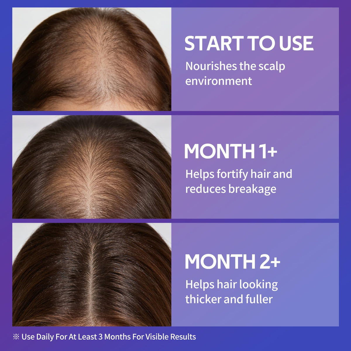 Close up of spray nozzle on hair growth serum bottle