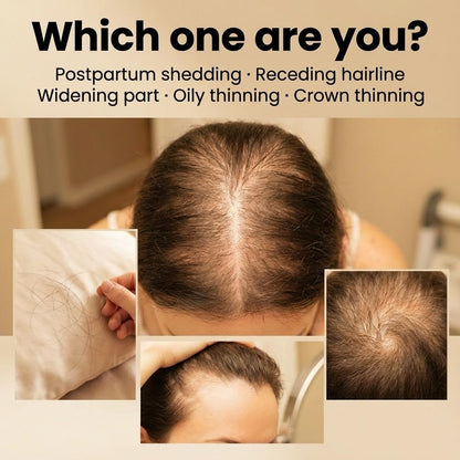 Daily leave-in scalp treatment lotion formula for reducing hair fall