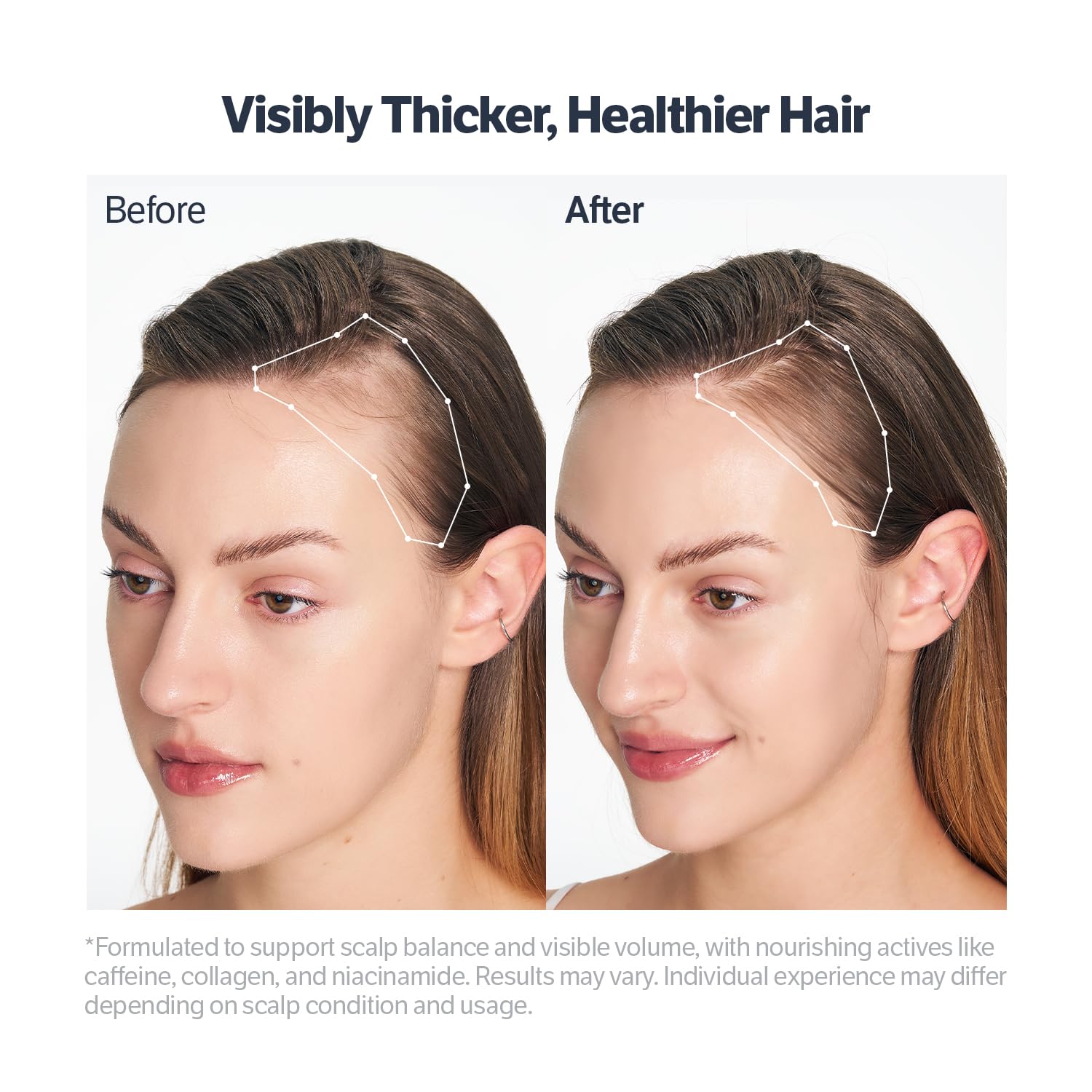 Korean roll-on scalp treatment for dry itchy scalp relief application